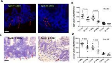Radiation-induced gastrointestinal GI syndrome as a function of age