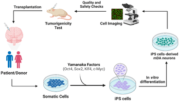 Stem Cells and Cell Factors Paving the Way for Future Breakthroughs in Parkinsons Disease Treatment
