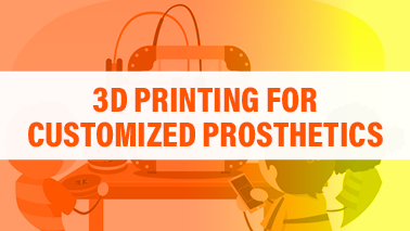 Peers Alley Media: 3D Printing for Customized Prosthetics