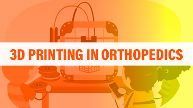 Peers Alley Media: 3D Printing in Orthopedics