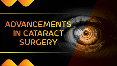 Peers Alley Media: Advancements in Cataract Surgery