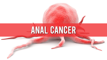 Peers Alley Media: Anal Cancer