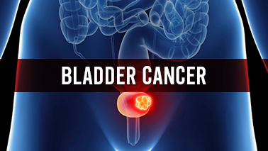 Peers Alley Media: Bladder Cancer