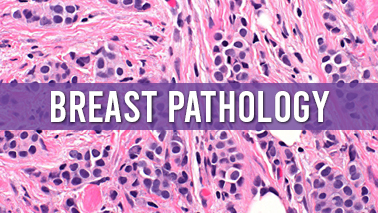 Peers Alley Media: Breast Pathology