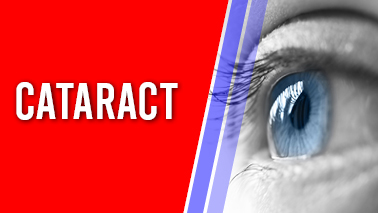 Peers Alley Media: Cataract