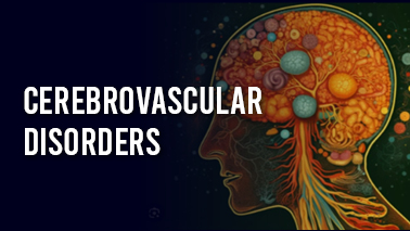Peers Alley Media: Cerebrovascular Disorders