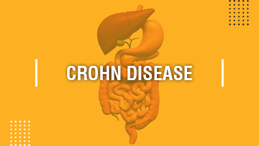 Peers Alley Media: Crohn Disease