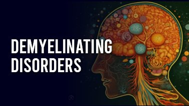 Peers Alley Media: Demyelinating Disorders