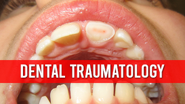 Peers Alley Media: Dental Traumatology