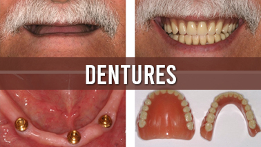Peers Alley Media: Dentures