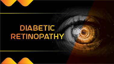 Peers Alley Media: Diabetic Retinopathy