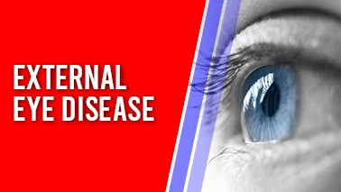 Peers Alley Media: External Eye Disease