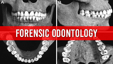 Peers Alley Media: Forensic Odontology