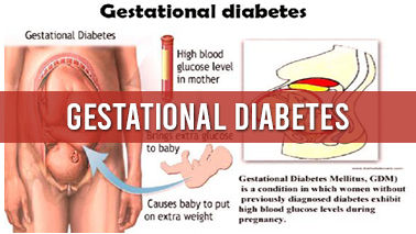 Peers Alley Media: Gestational Diabetes