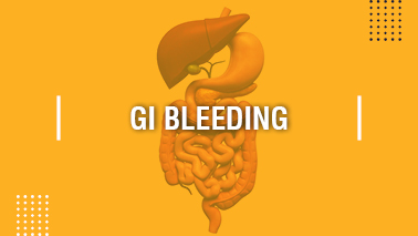 Peers Alley Media: GI Bleeding
