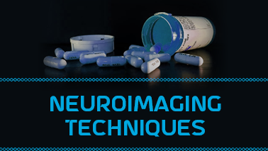 Peers Alley Media: Neuroimaging Techniques