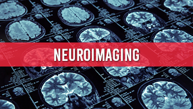 Peers Alley Media: Neuroimaging