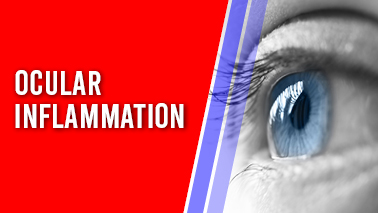 Peers Alley Media: Ocular Inflammation