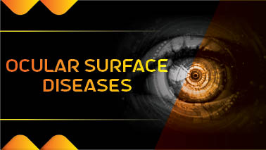 Peers Alley Media: Ocular Surface Diseases
