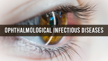 Peers Alley Media: Ophthalmological Infectious Diseases