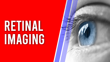 Peers Alley Media: Retinal Imaging