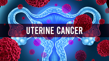 Peers Alley Media: Uterine Cancer