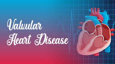 Peers Alley Media: Valvular Heart Disease