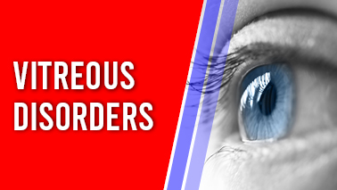 Peers Alley Media: Vitreous Disorders